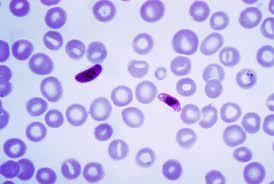 Name the specimen
