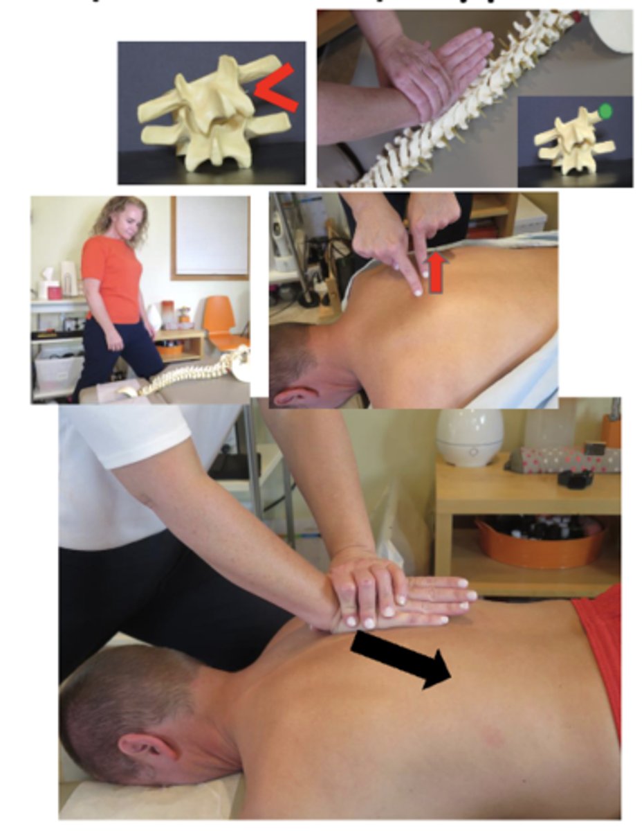 <p>• PP: Prone, asks permission to open gown/contact patient, verbalize finding the segment</p><p>• DP: Fencer or square stance facing caudal, side of adjustive contact, tissue slack M-L</p><p>• CH: Hypothenar of cephalic hand on Transverse Process (TP) (fingers running parallel to the spine)</p><p>• IH: Pisiform in anatomical snuff box, with fingers around wrist.</p><p>• Vector: P-A and S-I</p><p>• CLOSING THE WEDGE</p>