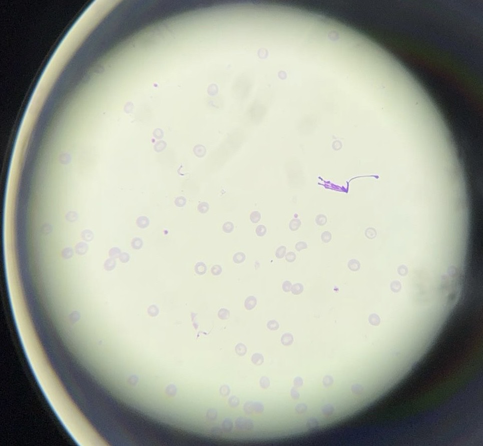 <p><span>What is this organism?</span></p>