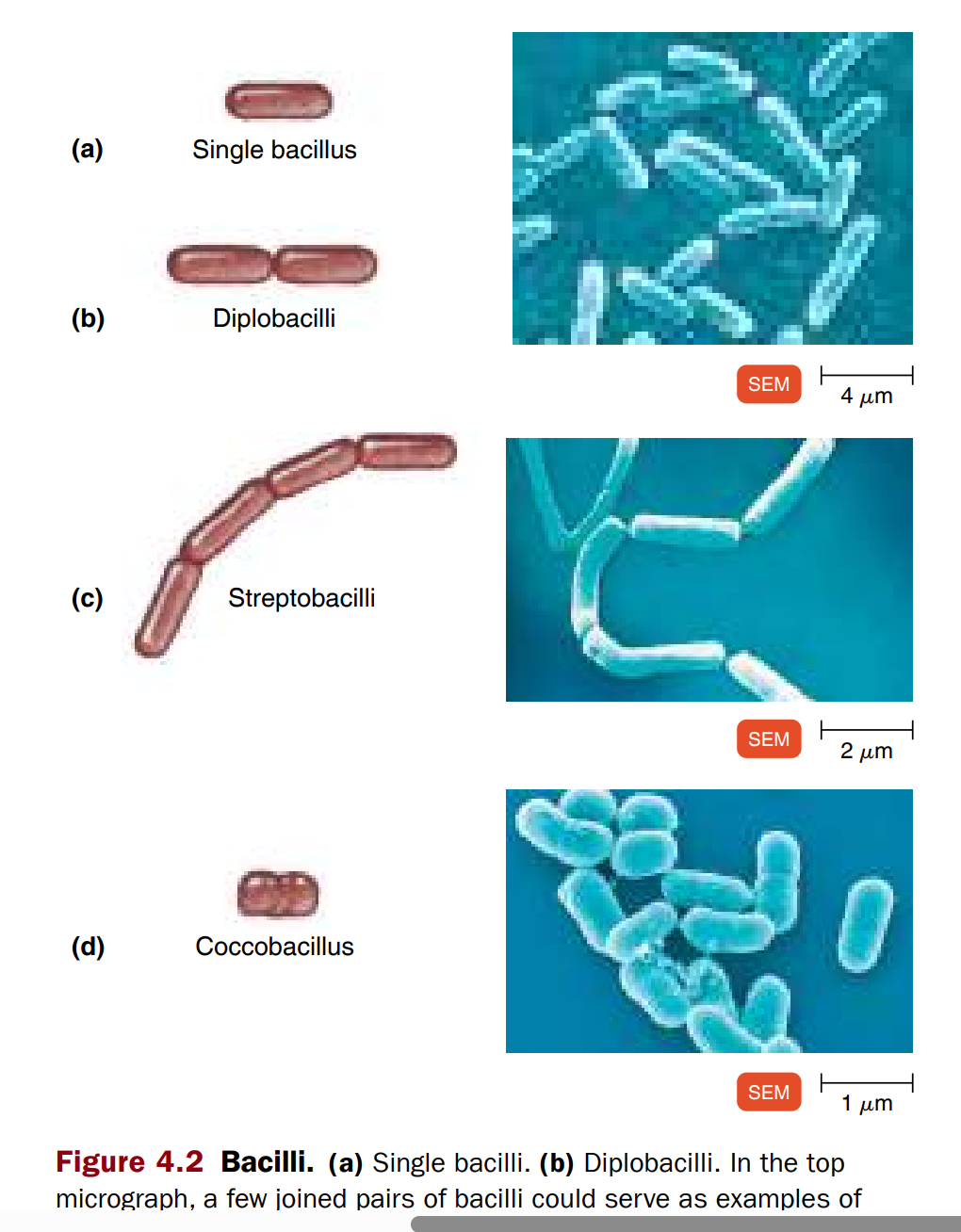 <ul><li><p><span style="background-color: transparent;"><em>Example</em>: <em>Bacillus anthracis</em> discovered by Robert Koch.<br><br></span></p></li></ul><p>Bacilli = <strong>rod-shaped bacteria</strong> (like little sticks). They divide across their short axis (side to side).</p><p>Here are the main forms:</p><div data-type="horizontalRule"><hr></div><p>1. <strong>Single bacillus</strong></p><ul><li><p>Just <strong>one rod</strong>.</p></li><li><p>Shape: like a tiny <strong>straw</strong>.</p></li></ul><div data-type="horizontalRule"><hr></div><p>2. <strong>Diplobacilli</strong></p><ul><li><p>After division, <strong>two rods stay stuck together</strong> → looks like <strong>a pair of straws</strong> side by side.</p></li></ul><div data-type="horizontalRule"><hr></div><p>3. <strong>Streptobacilli</strong></p><ul><li><p>They form a <strong>chain of rods</strong>, like a <strong>string of sausages</strong> or <strong>train cars</strong>.</p></li></ul><div data-type="horizontalRule"><hr></div><p>4. <strong>Coccobacilli</strong></p><ul><li><p>Short and fat rods → look kind of like <strong>round cocci (spheres)</strong>.</p></li><li><p>Think: <strong>between a rod and a ball</strong>.</p></li></ul><div data-type="horizontalRule"><hr></div><p><span data-name="point_right" data-type="emoji">👉</span> Easy picture in your head:</p><ul><li><p><strong>Single = one straw</strong></p></li><li><p><strong>Diplo = two straws stuck</strong></p></li><li><p><strong>Strepto = chain of straws</strong></p></li><li><p><strong>Coccobacilli = oval/ball-like rod</strong></p></li></ul><p></p><p></p><ul><li><p><span style="background-color: transparent;"><strong>Single bacillus</strong> → one rod.<br><br></span></p></li><li><p><span style="background-color: transparent;"><strong>Diplobacilli</strong> → pairs.<br><br></span></p></li><li><p><span style="background-color: transparent;"><strong>Streptobacilli</strong> → chains.<br><br></span></p></li><li><p><span style="background-color: transparent;"><strong>Coccobacillus</strong> → short, fat rods that look like cocci.<br><br></span></p></li><li><p><span style="background-color: transparent;"><em>Side note</em>: Some look like straws, some like cigars.<br><br></span></p></li><li><p><span style="background-color: transparent;">Only a few cause disease; others are not clinically important</span></p></li></ul><p></p>