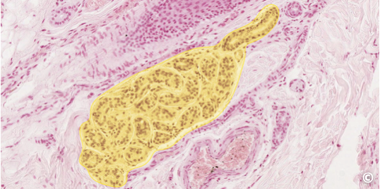 <p>identify type of exocrine gland</p>