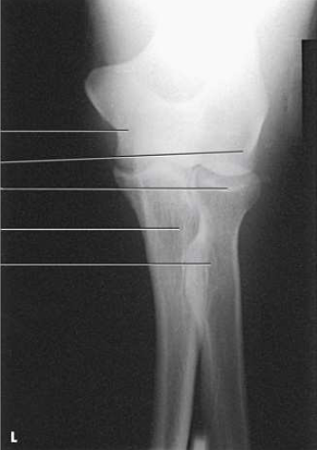 <p>What projection, position, and anatomy is this?</p>