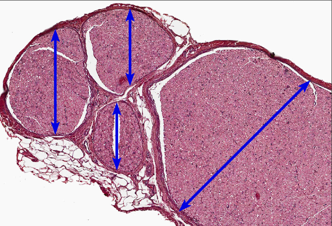 <p><span style="color: rgb(38, 38, 38)">The peripheral nervous system, located outside the central nervous system, consists of peripheral nerves, as well as their ganglia, nerve endings and ensheathments.&nbsp; Individual axons are surrounded by an endoneurium, not easily seen at this magnification.&nbsp; Groups of axons form a fascicle enclosed by a perineurium.&nbsp; Groups of ______ form major nerve trunks enclosed by an epineurium.&nbsp; 100x</span></p>