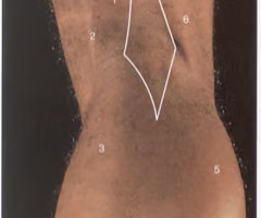 the hollow at the back of the knee
