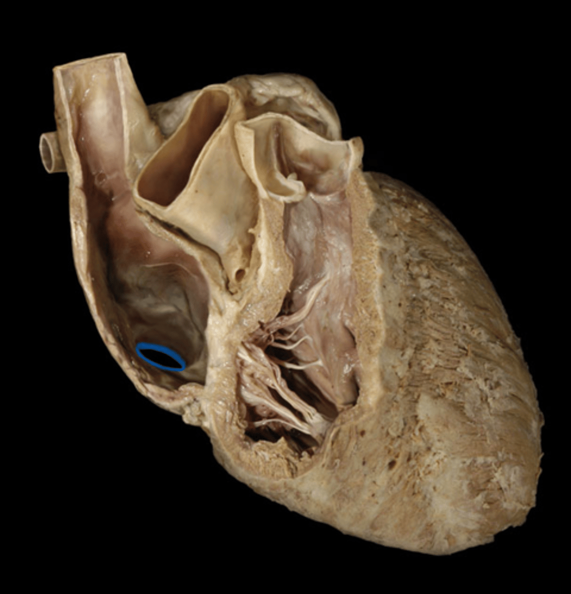 <p>opening; posterior side, end of probe, bottom of shoe, smaller opening at back<br>H6</p>