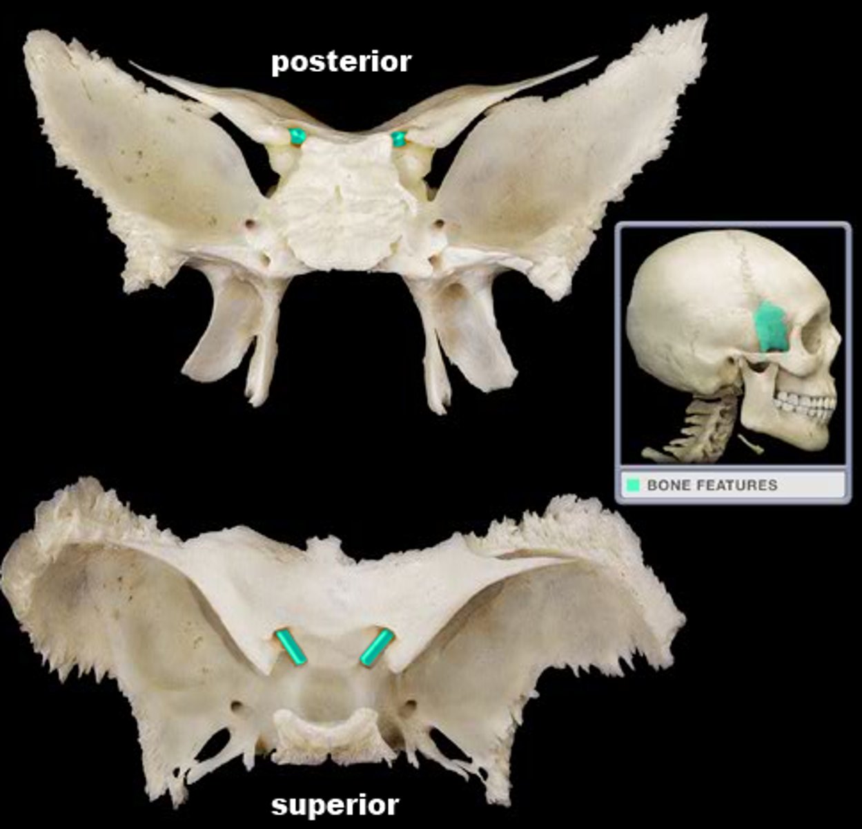 <p>location where optic nerves enter through</p>