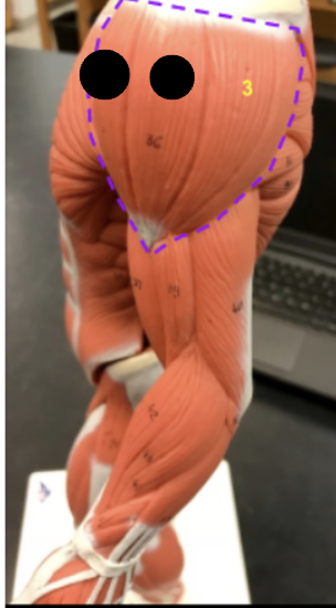 <p>What is #3 of the deltoid, the origin and the insertion?</p>