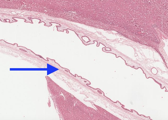 <p>The very thin pink line (tissue) arrowed (1.25x) is the?</p>