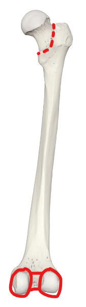 <p>What are the red areas called?</p>