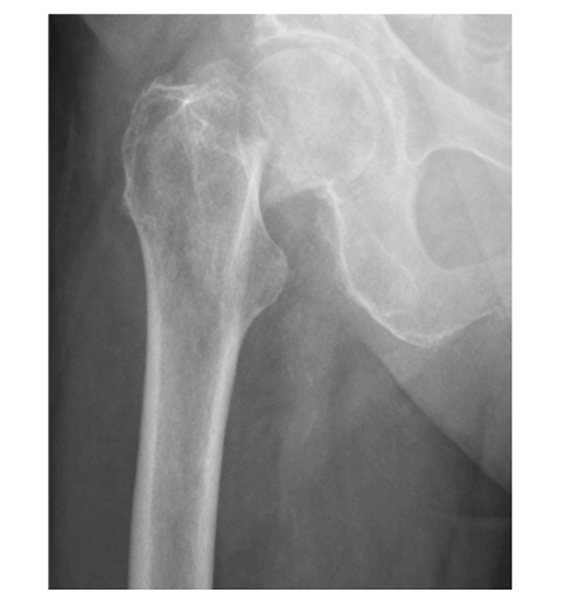 <p>Describe the MOST obvious "ABCS" component.</p>