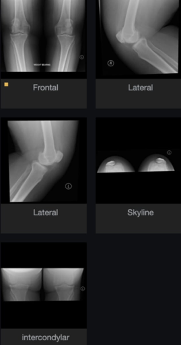 <p>Describe findings</p>