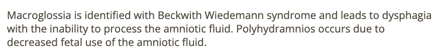 <p>d) beckwith wiedemann syndrome</p>