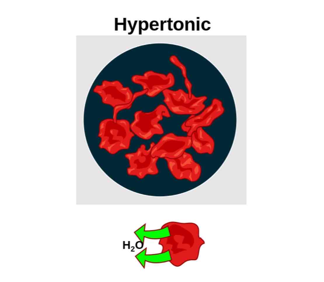 <p>A solution with more solutes than the cell, with water rushing out of the cell.</p>