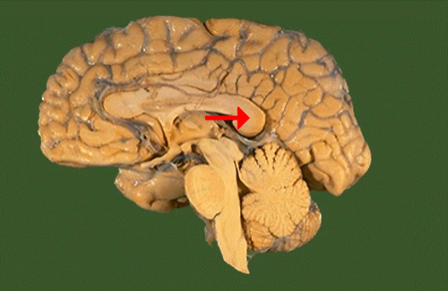 <p>ID (be specific)</p>