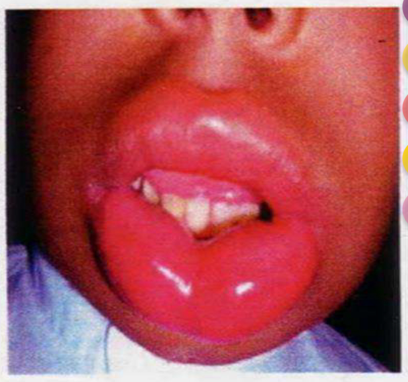 <p>Disease; caused by?</p>