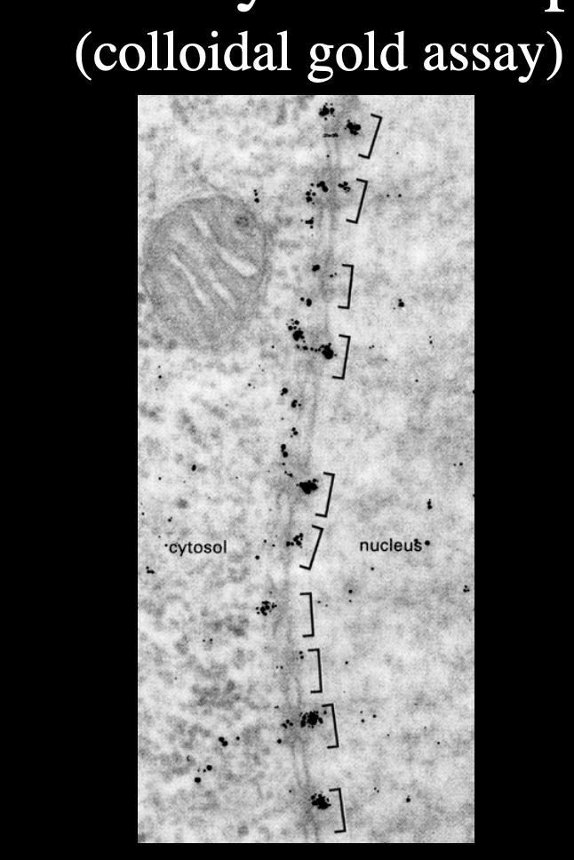 <ul><li><p>Gold particles all line up and enter through nuclear pore</p></li></ul><p>→ gold is too big a particle→ so highlights where the pores are</p>