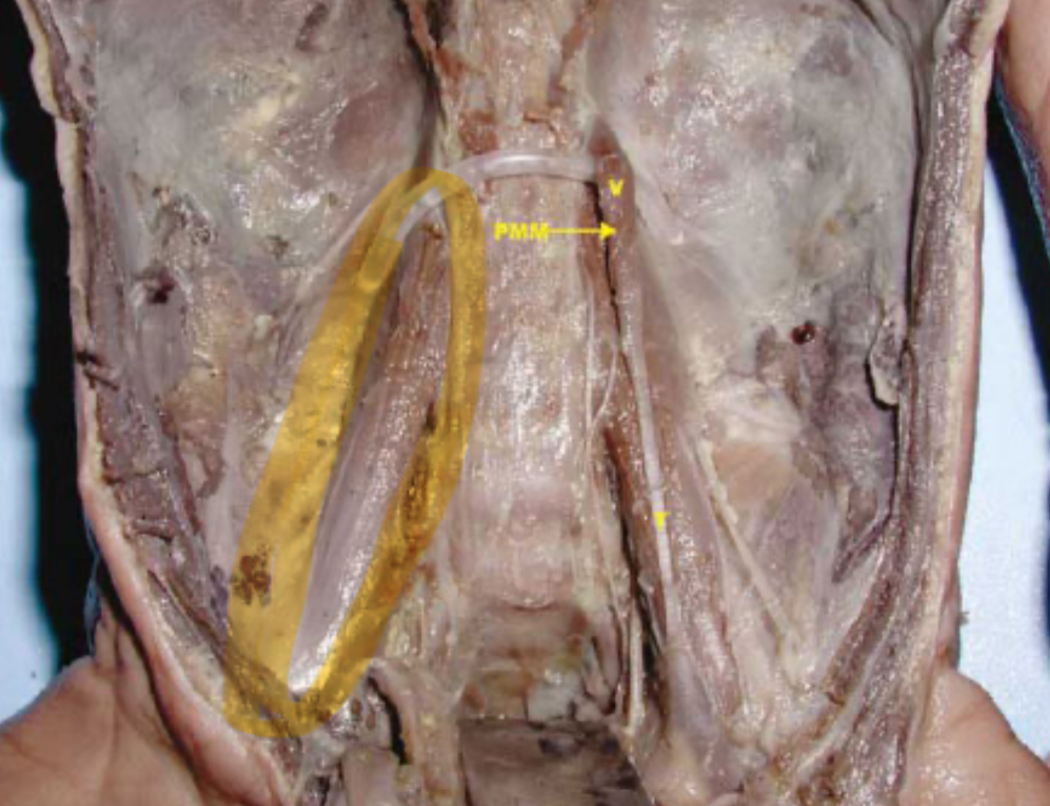 <p>Action: flex vertebral column; flex hip </p><p>Major hip flexors muscle located in the lower back &amp; pelvis </p>