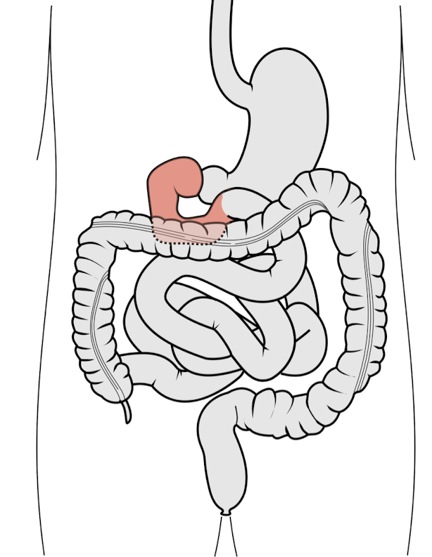 <ul><li><p>Duodenum</p><ul><li><p>C Shaped Tube</p></li><li><p>Location:</p><ul><li><p>Back Abdominal Wall of Abdomen </p></li><li><p>Posterior side of the body </p></li></ul></li></ul></li><li><p>L4</p></li></ul><p></p>