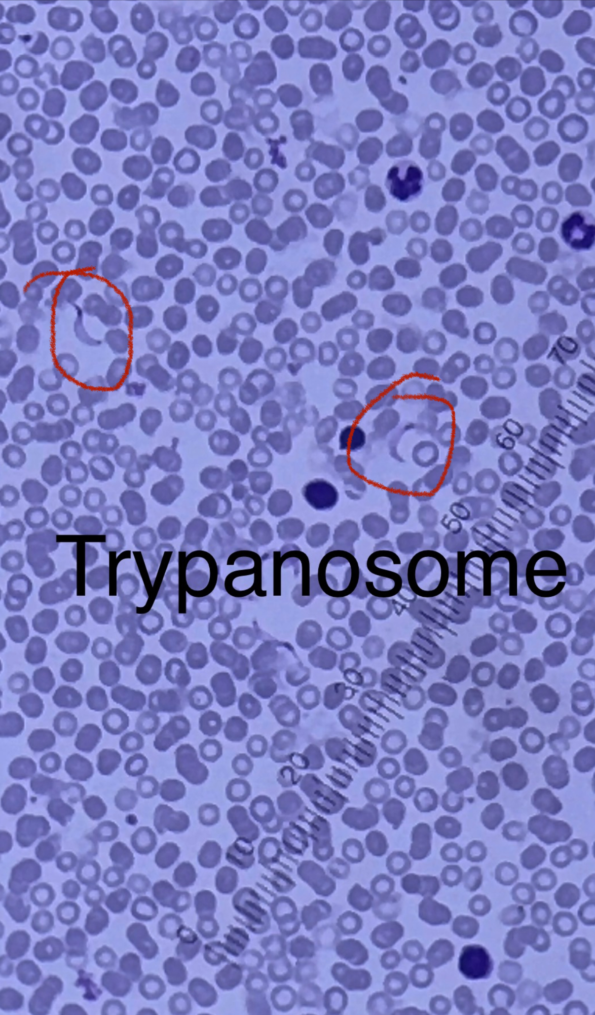 <p>Domain: Eukarya</p><p>Kingdom: Protista</p><p>Phylum: Euglenozoa</p><p>Genus: Trypanosoma</p><p>Species: cruzi &amp; brucei</p><p>Pathogen</p><p>Transmitted by biological vectors; Reservoirs: Tigers, elephants, etc.</p><p>Seen outside of red blood cells</p><p>Purple looking banana parasite about 3 red blood cells long</p><p>T. cruzi causes Chaga’s disease (kissing bug) - symptoms- Myocarditis and congestive heart failure</p><p>T. brucei causes African sleeping sickness from the (tsetse fly) - symptoms- headache, drowsiness,, and death</p>