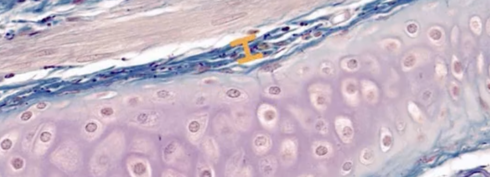 <p>What part of the cartilage has a orange bar?</p>