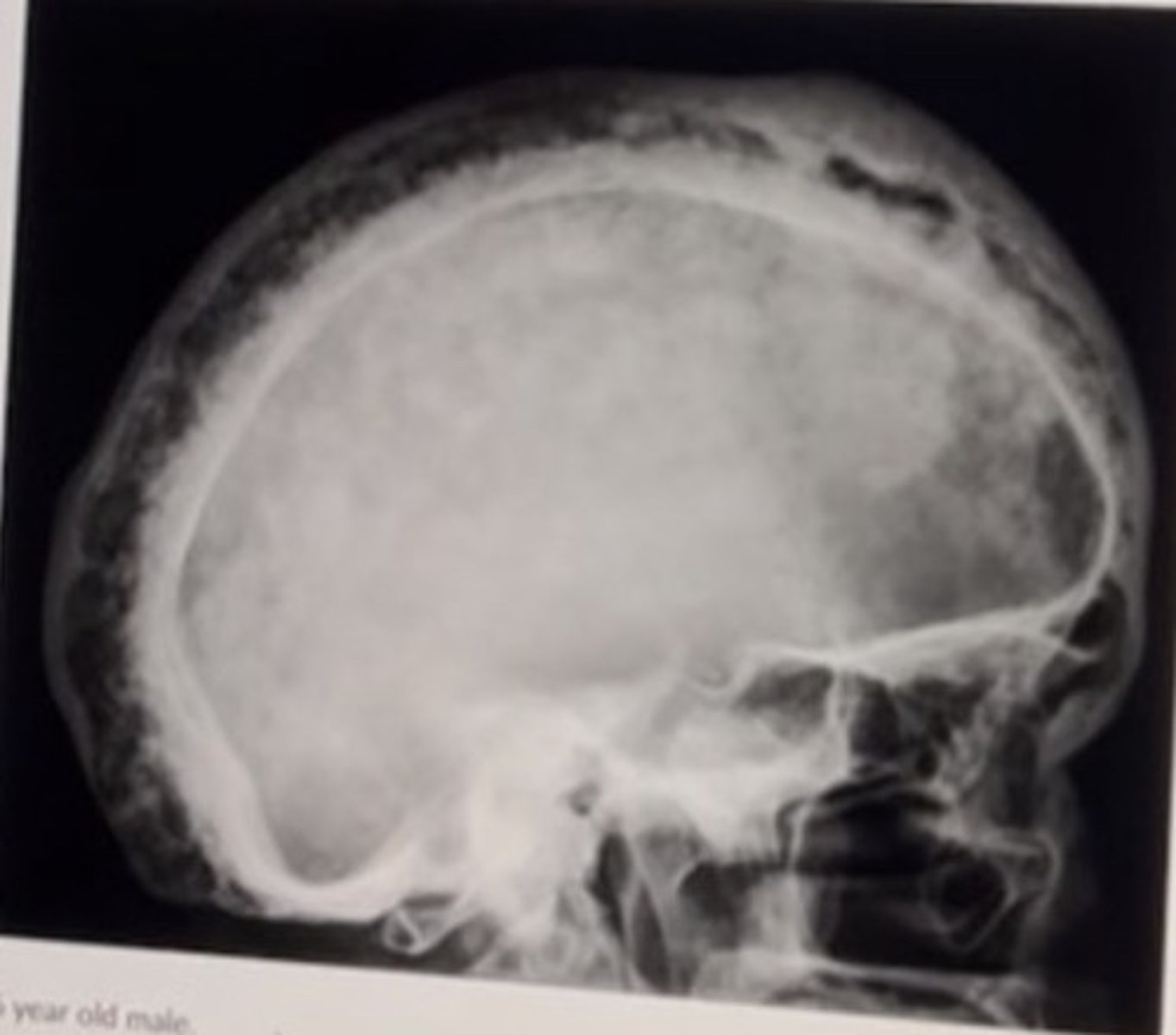 <p>76 year old male.</p><p>The name sign seen above is:</p>