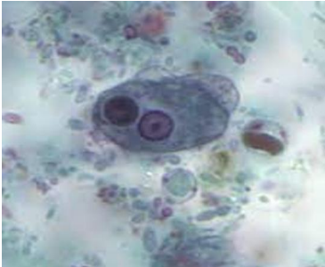 <p>what is this ?</p><p>phylum ?</p><p>origin of locomotion ?</p><p>parasitic value of this stage ?</p><p>two special characters ?</p><p>مش في اللي احنا شوفناهم في سكشن المراجعه</p>