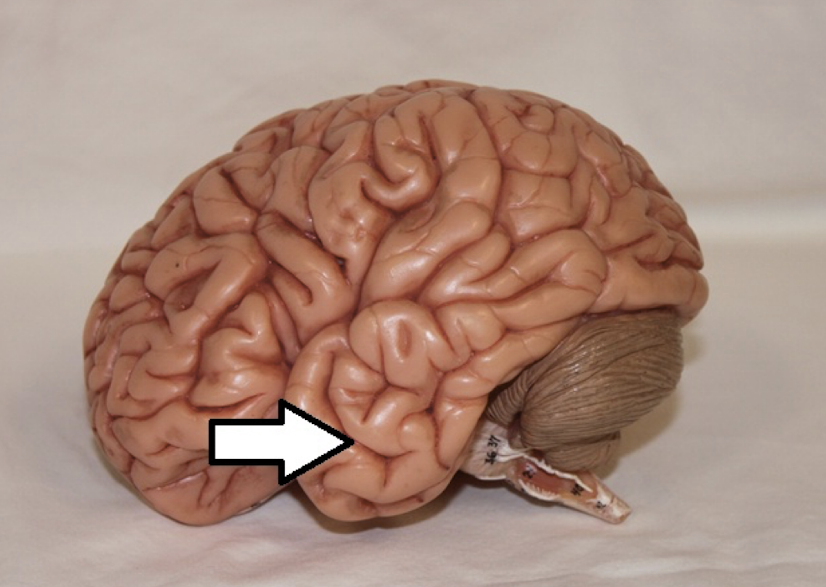 <p>identify this structure (lobe)</p>