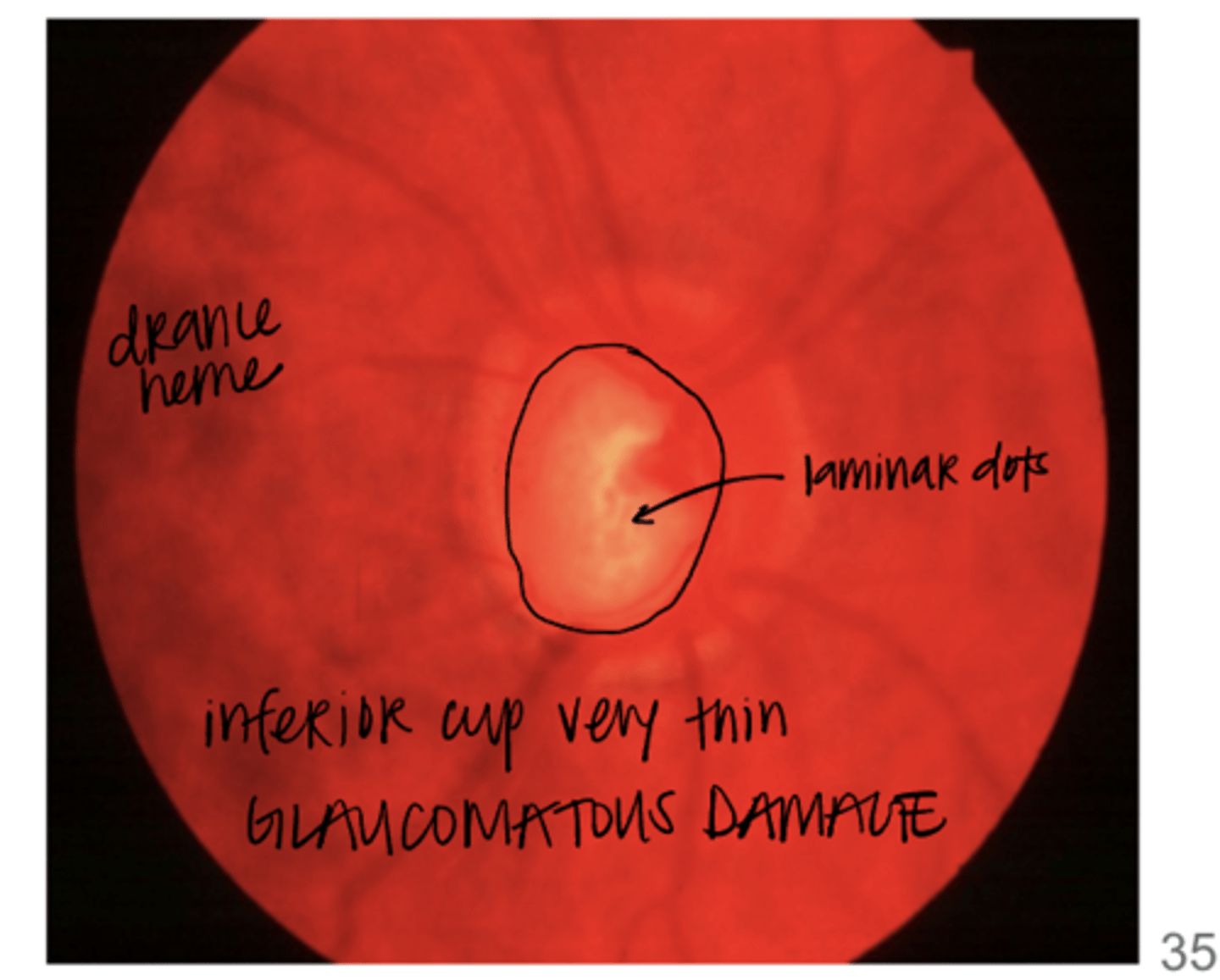 <p>Does this nerve follow the ISNT rule?</p>