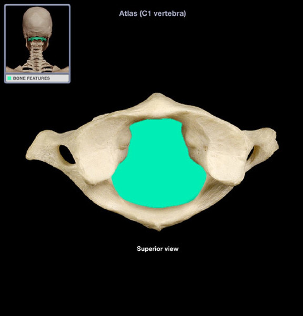 <p>(what vertebra and what structure is highlighted)</p>