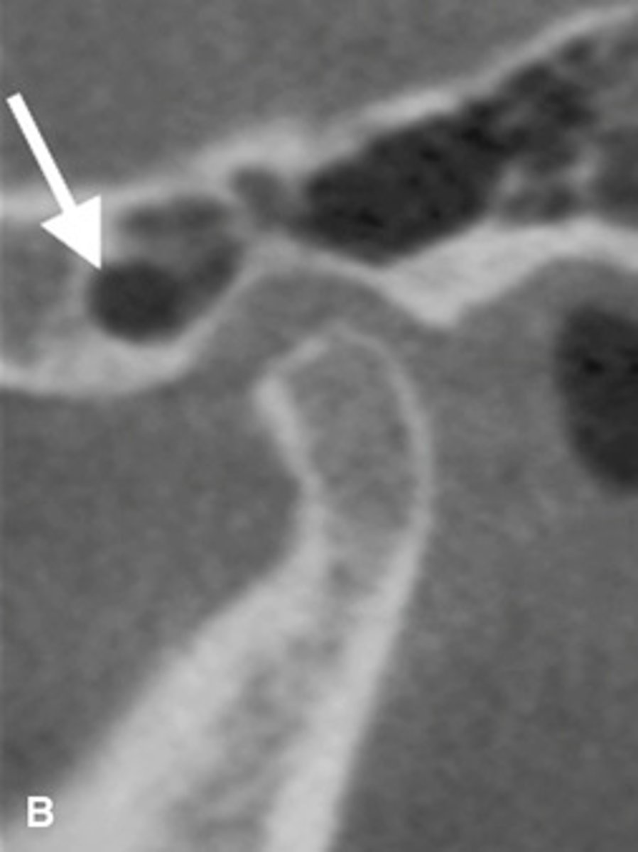 <p>Is this pathological?</p>