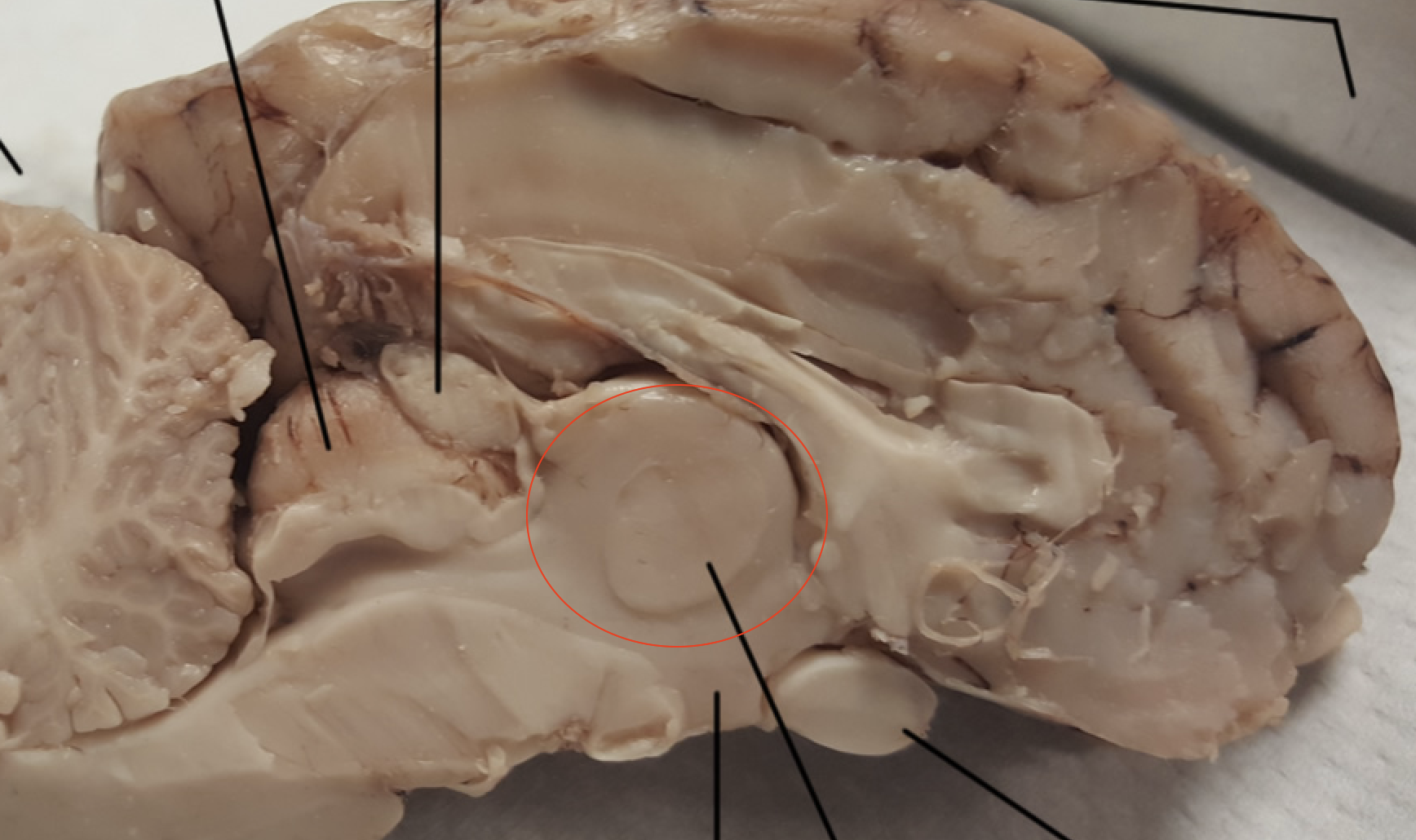 <p>The body’s information relay station—<span>all information from the body's senses (except smell) are processed through this structure before being sent to the brains cerebral cortex</span></p>