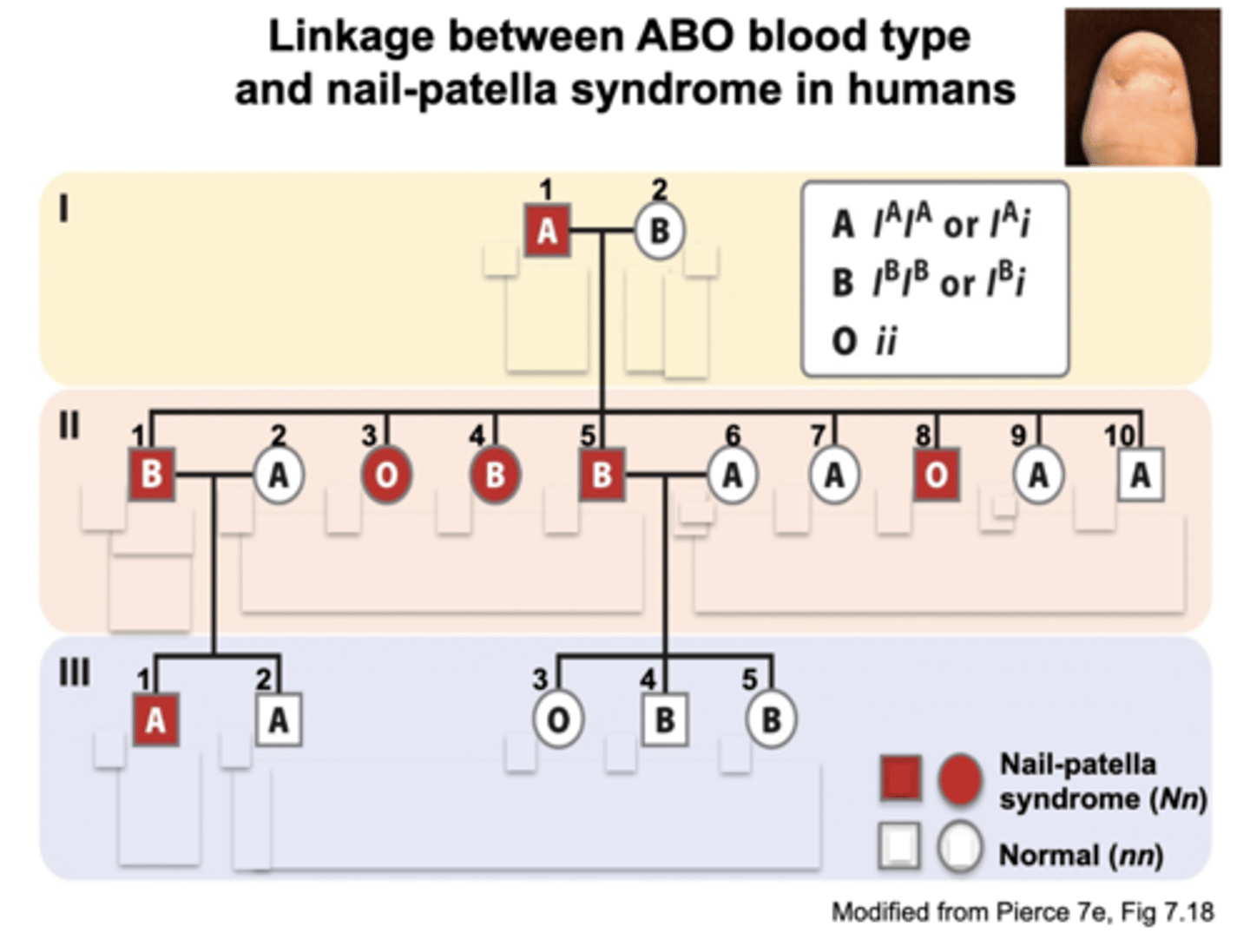 <p>Look over the following pedigree and understand where the blood types come from and how the syndrome is passed on</p>