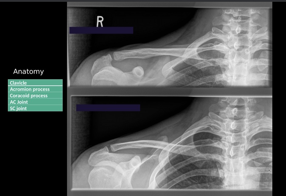 <p>What projection position is the bottom image?</p>