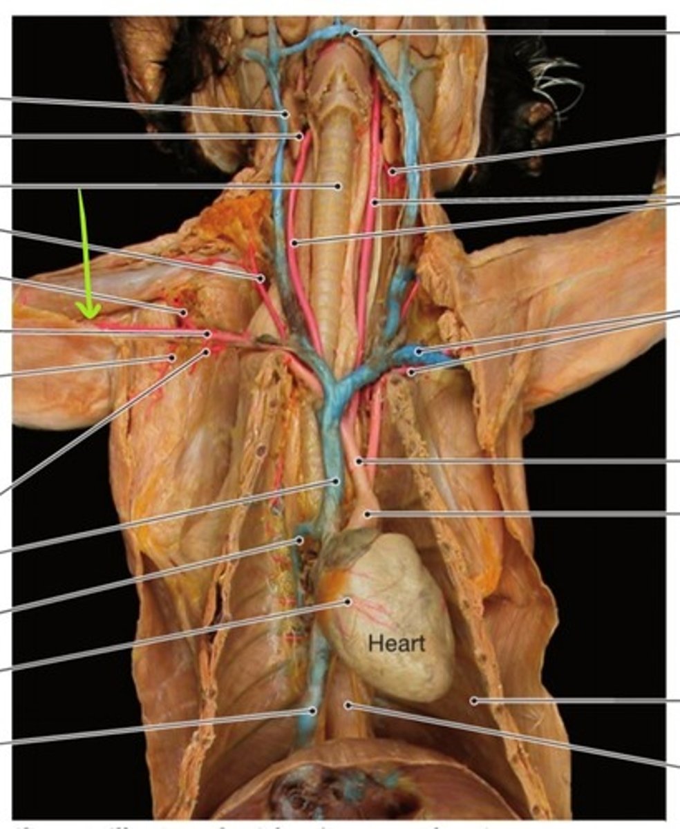 <p>identify this artery</p>