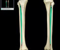 fibrous joint that permits some movement
