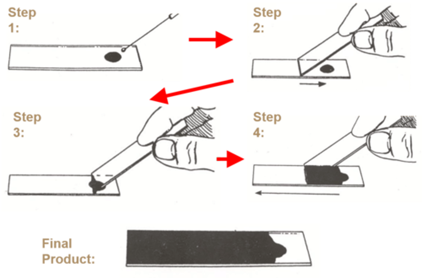 <p>This procedure is for the</p>
