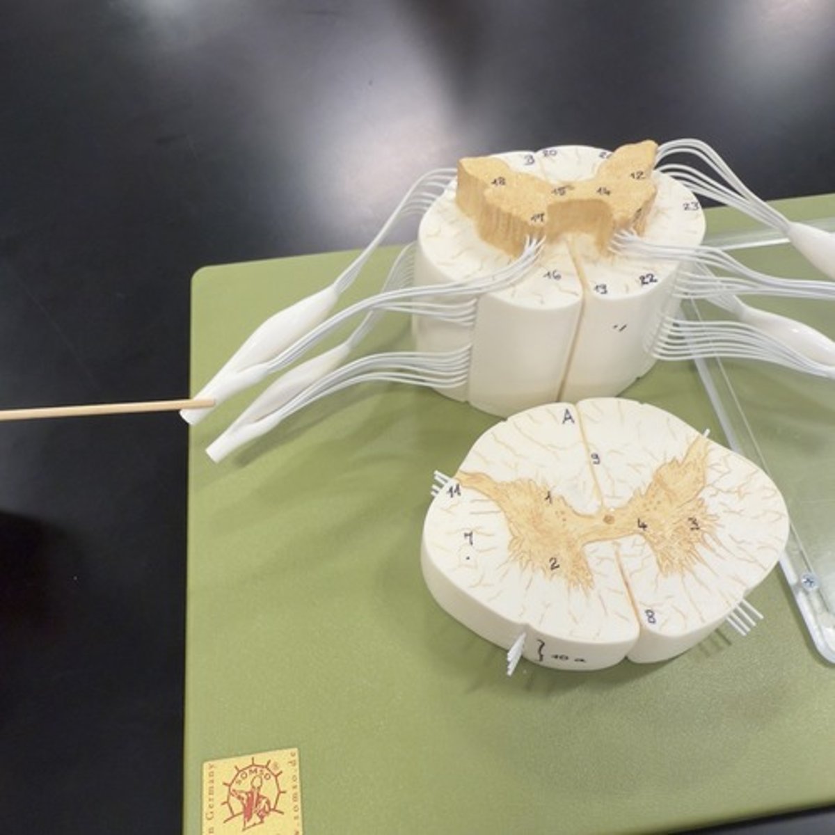 <p>Identify the structure.</p>