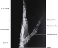 <p><span>-to see foreign body entrance and exit (localizing)<br>-and metacarpal fx.</span></p>