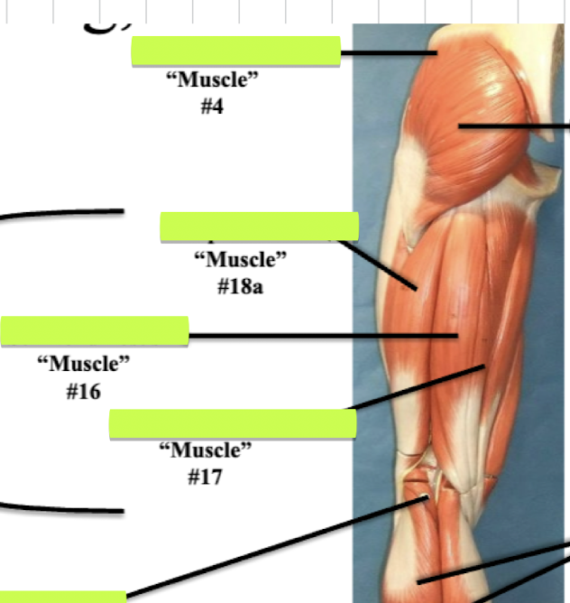 <p>Label muscle #16 </p>