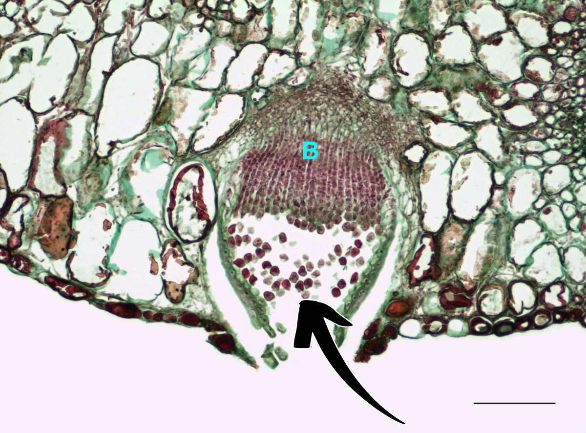 <p>Puccinia graminis: Vilken spor är detta?</p>