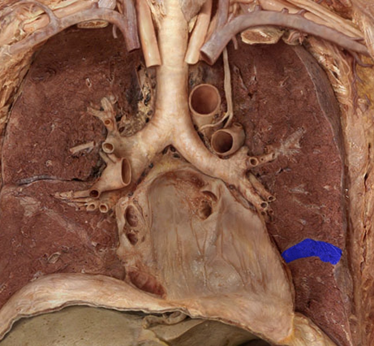 <p>Label the Lung Segment</p>