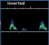 <p>what type of resistance waveform does this show (arterial)?</p>