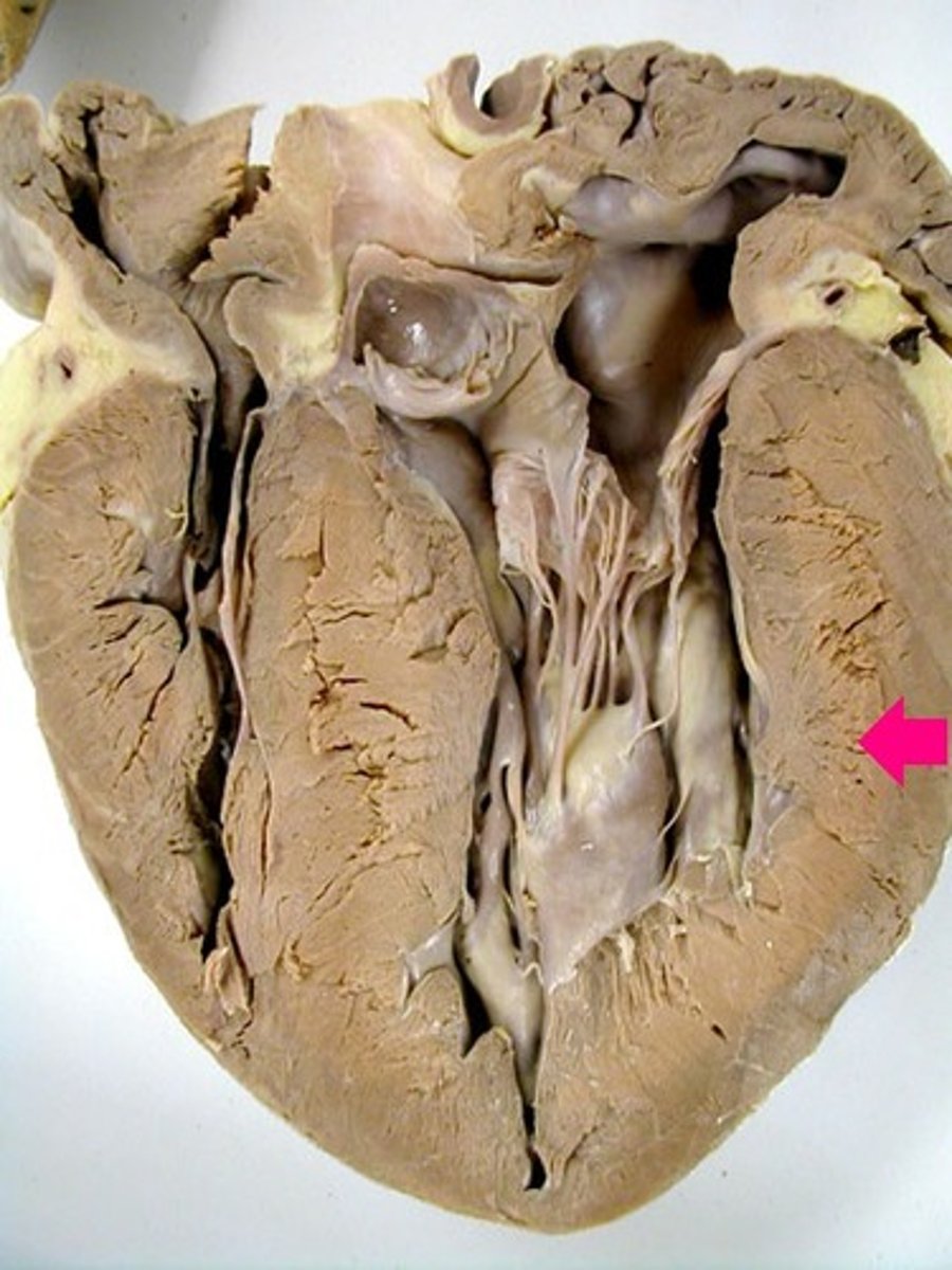 <p>Identify the muscle layer.</p>
