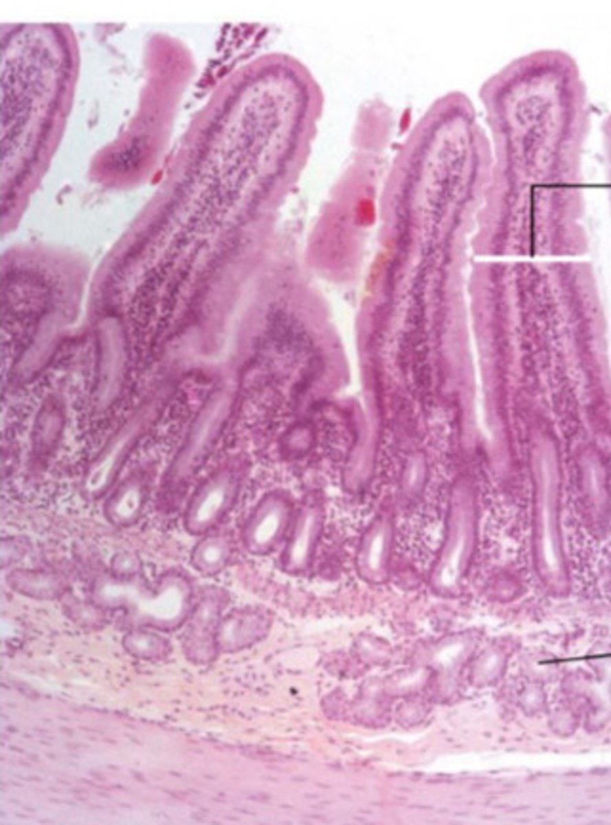 <p>ID the Histology</p>