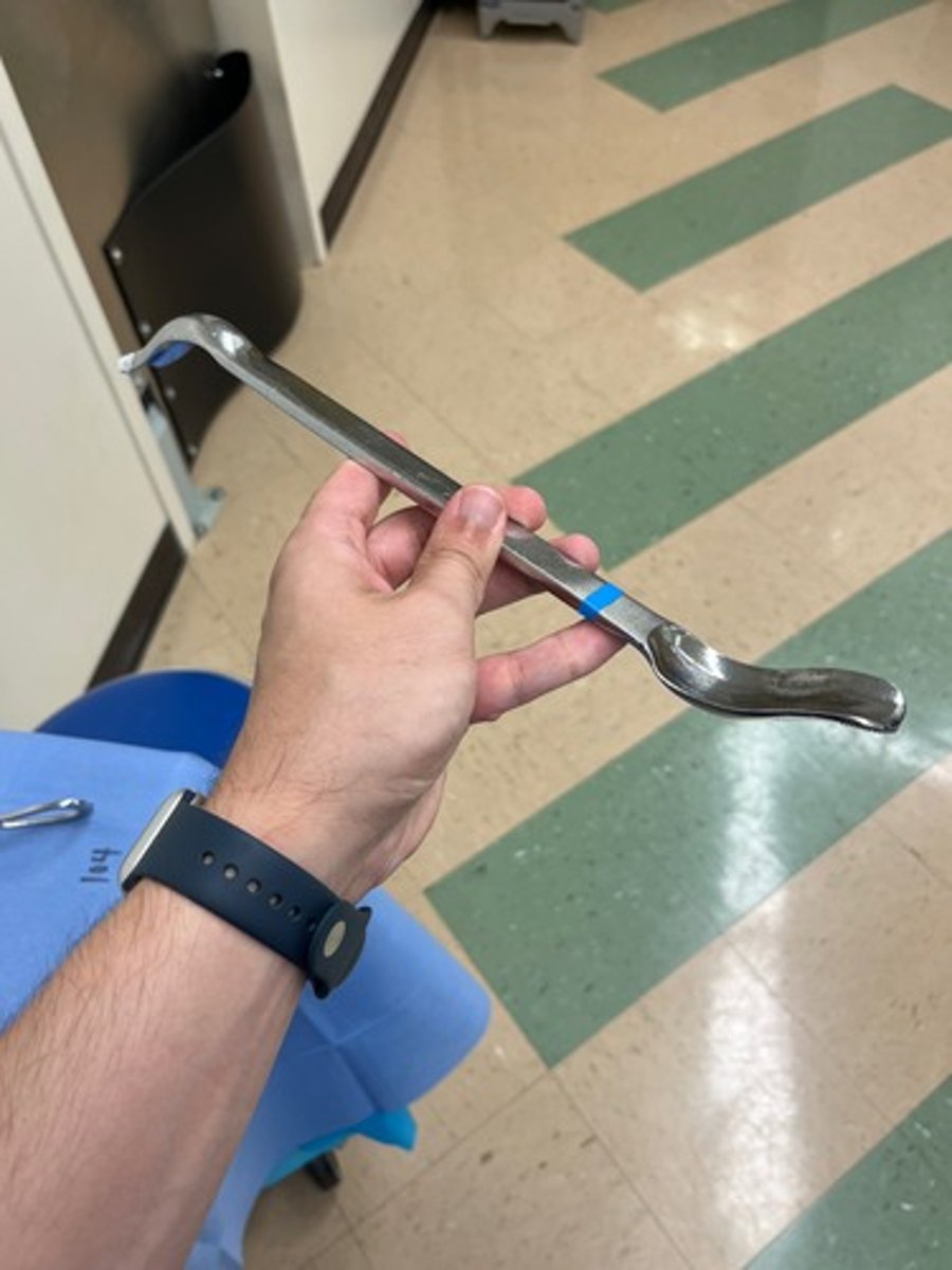 <p>Looks like a shoe horn</p>