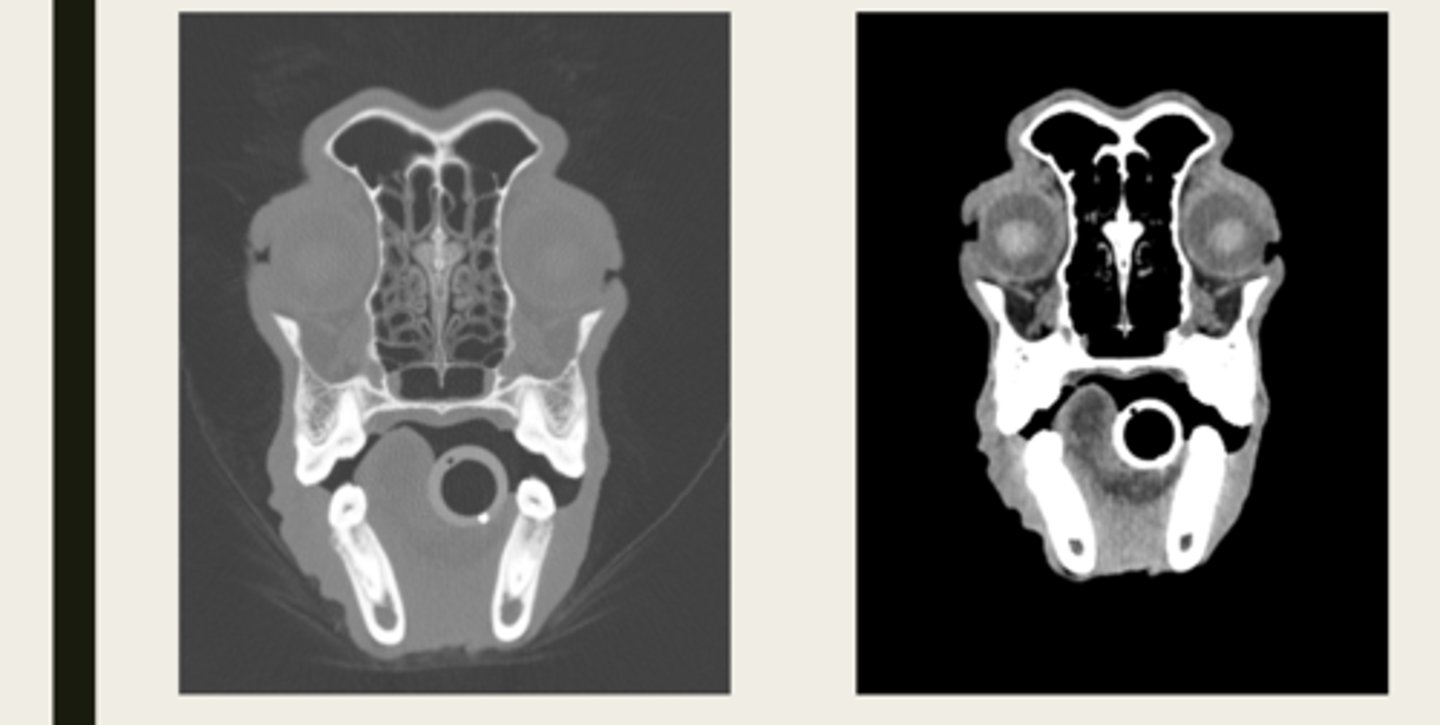 <p>which CT window shows bone window or tissue window?</p>