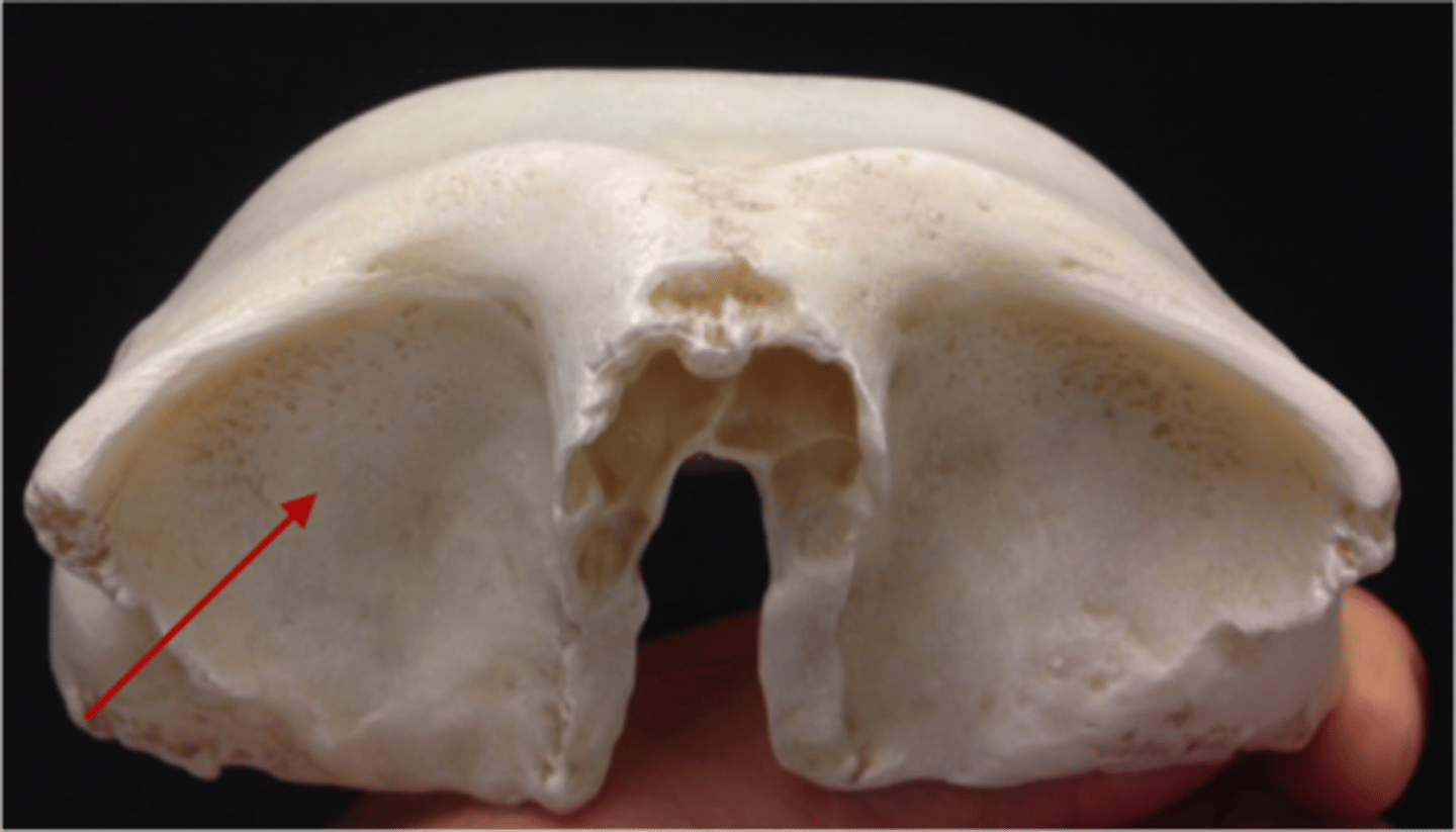 <p>-separate the orbits from cerebral frontal lobe</p>