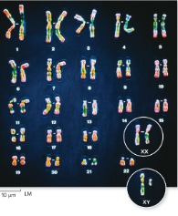 <p>Karyotype</p>