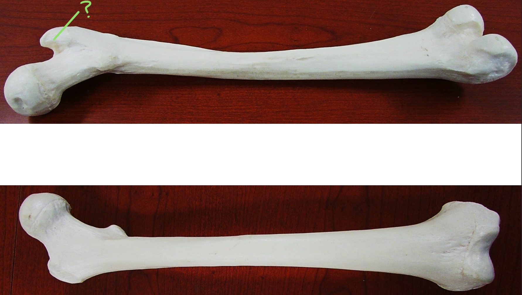 <p>Determine the part of the Femur highlighted</p>