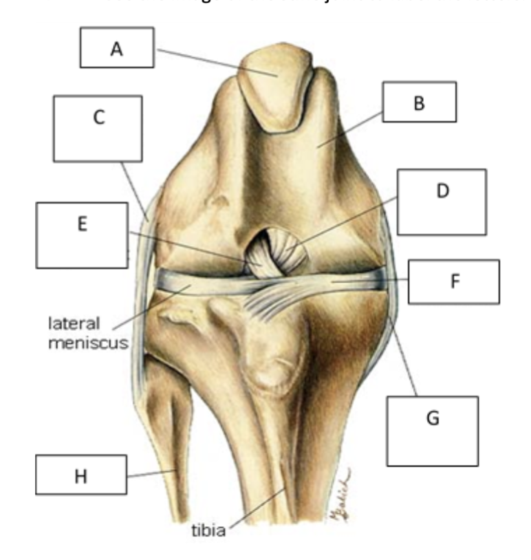 <p>A</p>